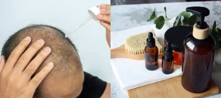 Invima alerta por spray contra la caída del cabello que se vende sin autorización sanitaria